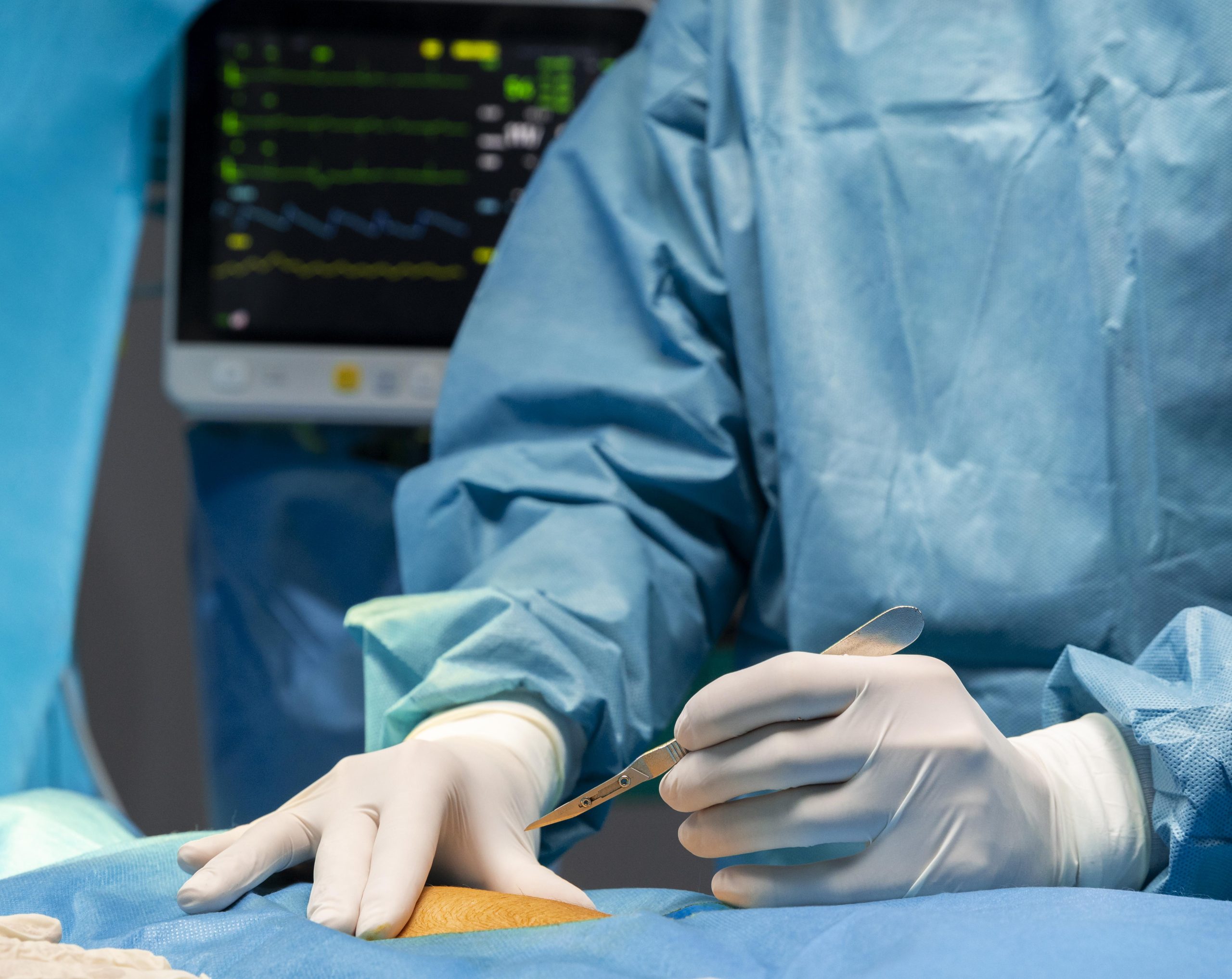 Médicos de cirugía reconstructiva